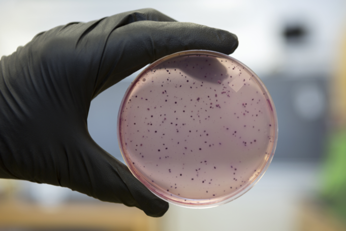 E.coli Water Contamination